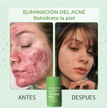 LED Facial PielReset® + 2 GreenMask® ¡GRATIS!