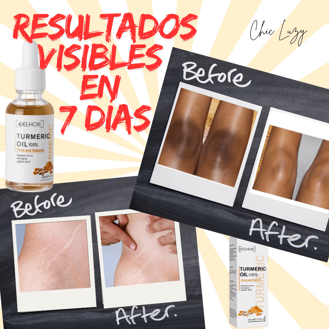 Aceite Cúrcuma Piel® - Manchas fuera en 7 días
