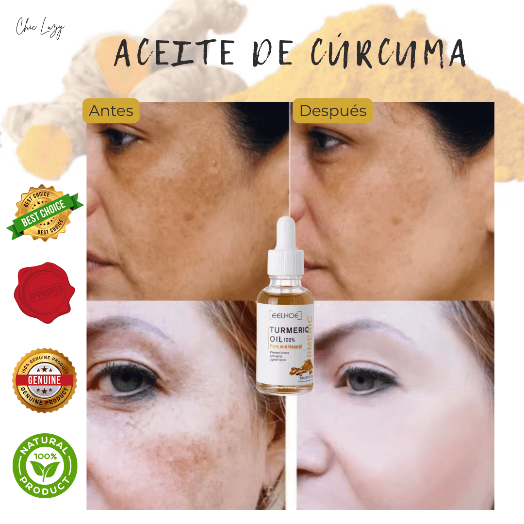 Aceite Cúrcuma Piel® - Manchas fuera en 7 días