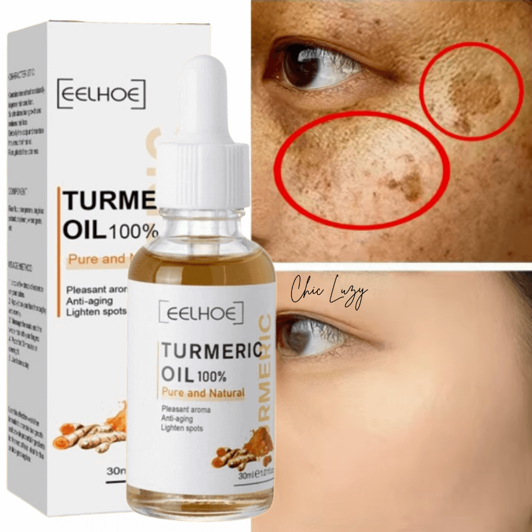 Aceite Cúrcuma Piel® - Manchas fuera en 7 días